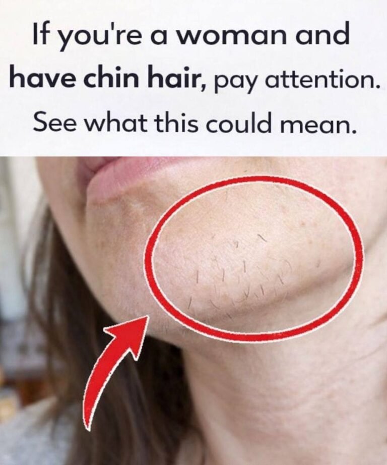 Common Reasons for Unwanted Facial Hair Growth in Women