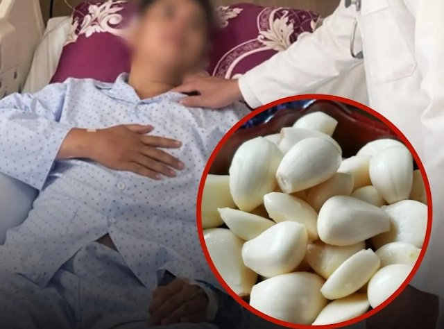 He Ate Garlic Every Morning to “Prevent Can.cer” — Then a Routine Checkup Delivered Shocking News