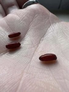 A Family’s Warning After a Sudden, Devastating Tick-Borne Illness