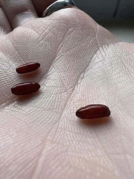 A Family’s Warning After a Sudden, Devastating Tick-Borne Illness