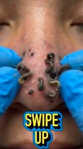 Something Unusual Was Emerging From the Nose — Here’s What This Shocking Image Could Mean