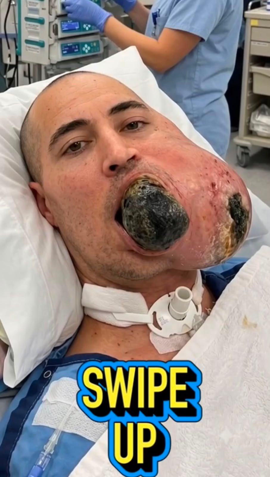 The Alarming Facial Swelling in This Image: What Could Cause Severe Lip Lesions?