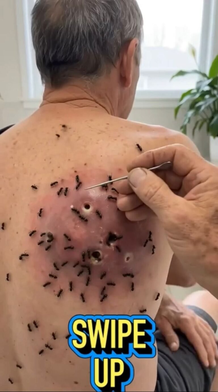 🩺 When a Skin Problem Looks Like Something Else: Understanding Unusual Skin Lesions and Infestations