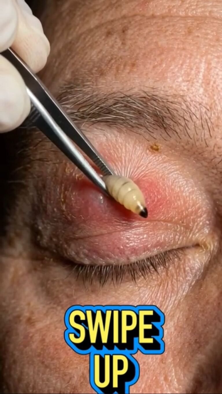 When Something Unexpected Appears on the Skin: The Medical Conditions Behind These Shocking Images