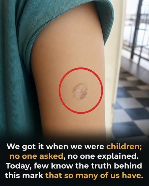 A Small Mark From Our Childhood Holds A Story Many People Never Learned