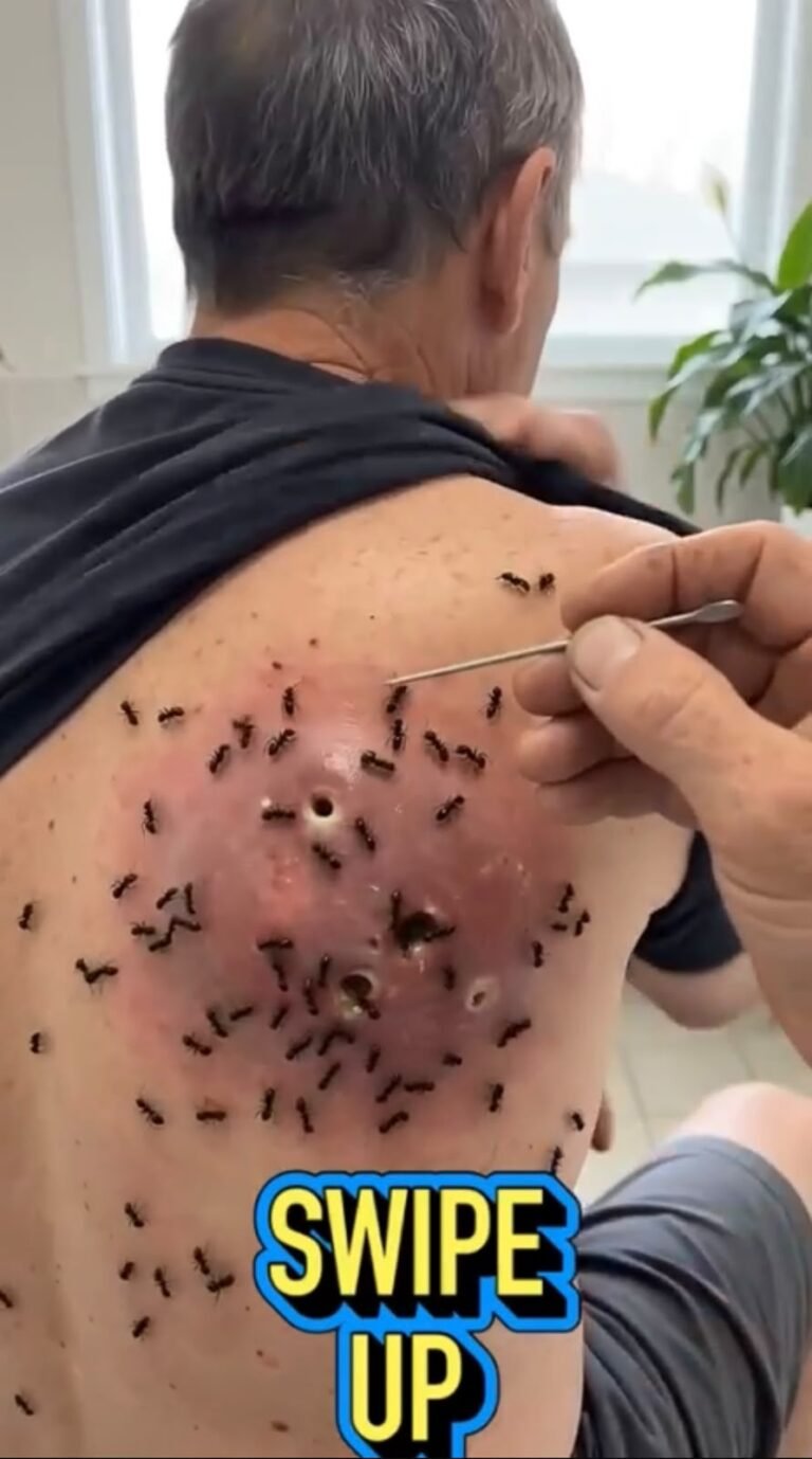 A Startling Skin Reaction: What Could Cause Severe Swelling, Open Lesions, and Insect Exposure?