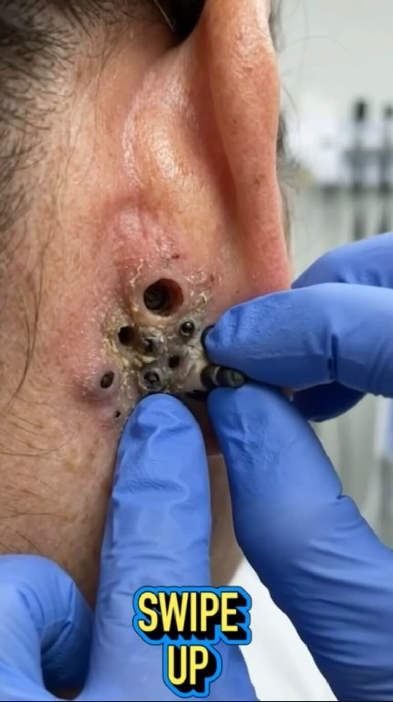 A Closer Look at an Unusual Ear Skin Condition: Why Medical Evaluation Matters